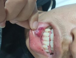 Orang Tua Siswa Korban Aksi Kekerasan Di SKO Ragunan, Akan Tempuh Jalur Hukum.