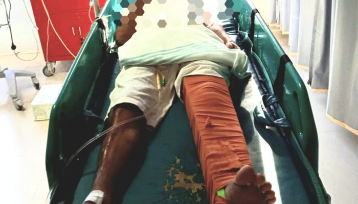 Kecelakaan di JJLS Saptosari-Panggang, Pemotor RX King Patah Tulang