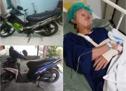 Laka Jalan Wonosari-Baron, Satu Pemotor Patah Tulang
