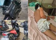 NMax Vs Beat di Semanu, Pembonceng Alami Patah Tulang
