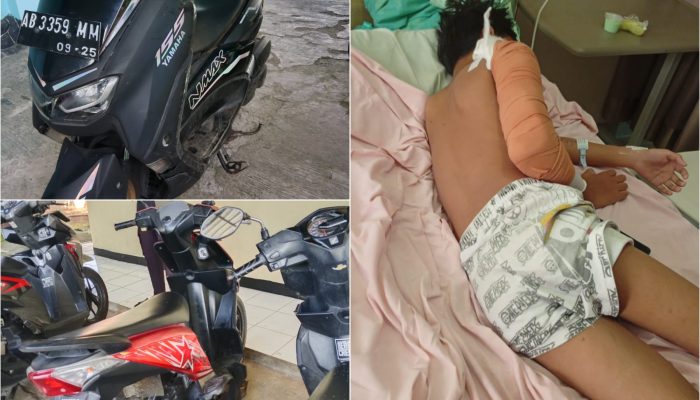 NMax Vs Beat di Semanu, Pembonceng Alami Patah Tulang