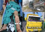 Truk Tabrak Sepeda Motor di Jalan Ngawen-Cawas, Pembonceng Patah Tulang