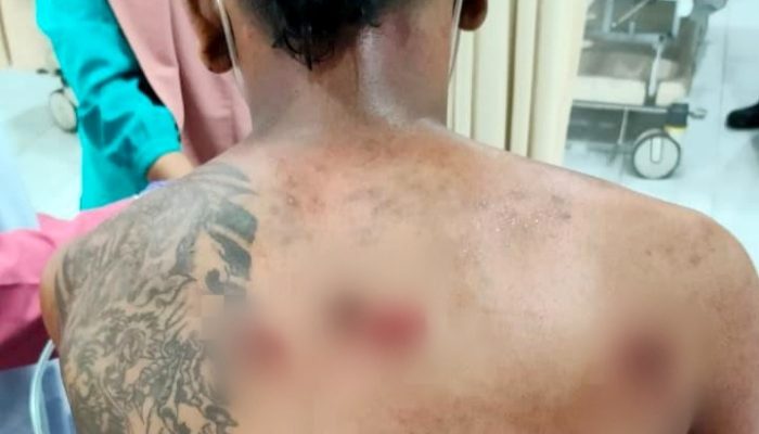 Pedagang Bakwan di Gondomanan Ditusuk Rekannya, Polisi: Motif Masih Diselidiki