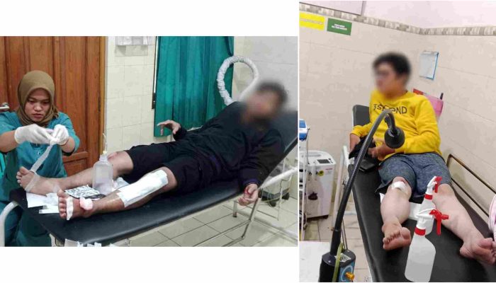 Hindari Mobil di Tanjakan Patuk, Dua Mahasiswa Jatuh dari Motor