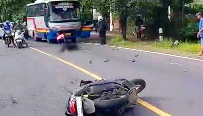 Mahasiswi Wonogiri Kecelakaan di Jalur Jogja-Wonosari Saat Salip Truk, Alami Patah Kaki