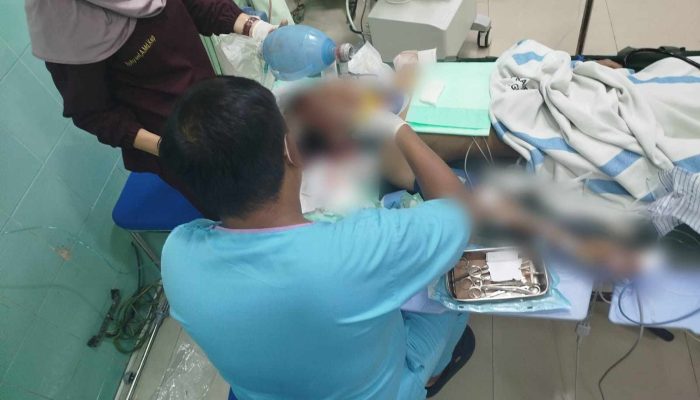 Remaja di Gunungkidul Koma Usai Motor Oleng saat Coba Salip Bus di Patuk