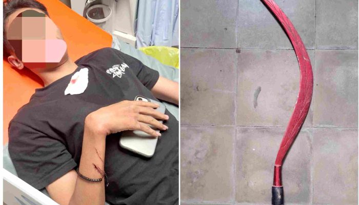 Remaja di Bantul Jadi Korban Penganiayaan di Simpang Dawetan