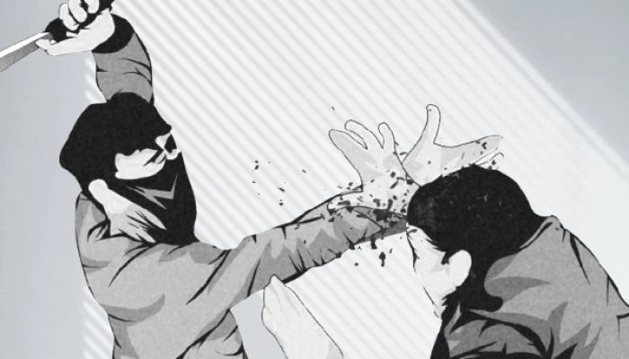 Duduk Santai di Teras, Pria di Bantul Tiba-tiba Dibacok Orang Tak Dikenal