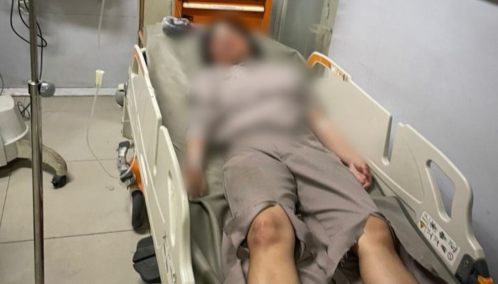 Niat Hindari Jalan Rusak, Pengendara Honda Vario Terjatuh di Patuk