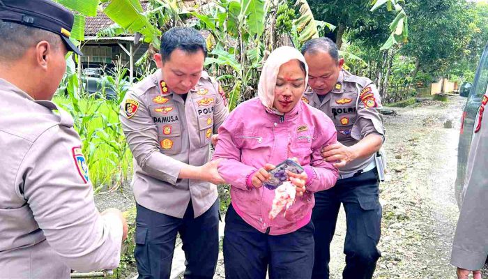 Di Tengah Agenda Dinas, Kapolres Gunungkidul Selamatkan Ibu Korban Kecelakaan di Jalan Berlubang