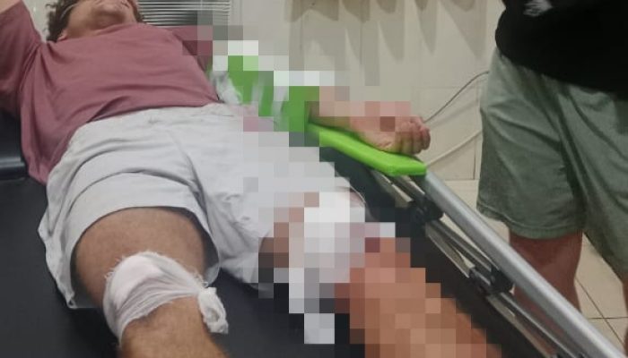 Kecelakaan Tunggal di Patuk, Turis Asal Belanda Alami Patah Lengan